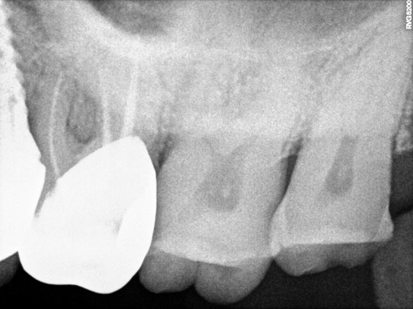 Dental X-ray